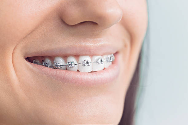 Best Traditional Braces  in North Shore, VA